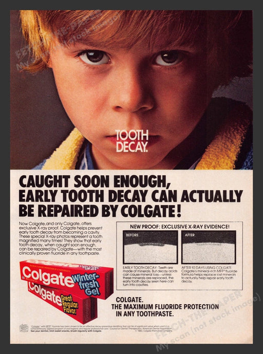 1983 Colgate Toothpaste Tooth Decay Fluoride Print Advertisement Ad