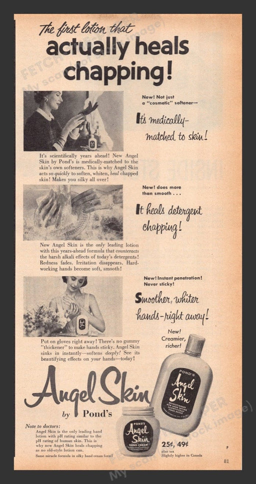 1956 Pond's Angel Skin Lotion Heals Chaping Print Advertisement Ad